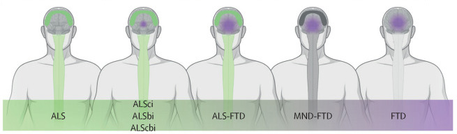 The Lancet, Figure 1 C: amyotrophic lateral sclerosis occurs on a continuum with frontotemporal dementia
